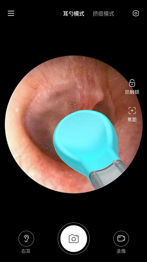 xlife���ܿ��Ӳɶ���appv1.0.60��׿���ͼ2