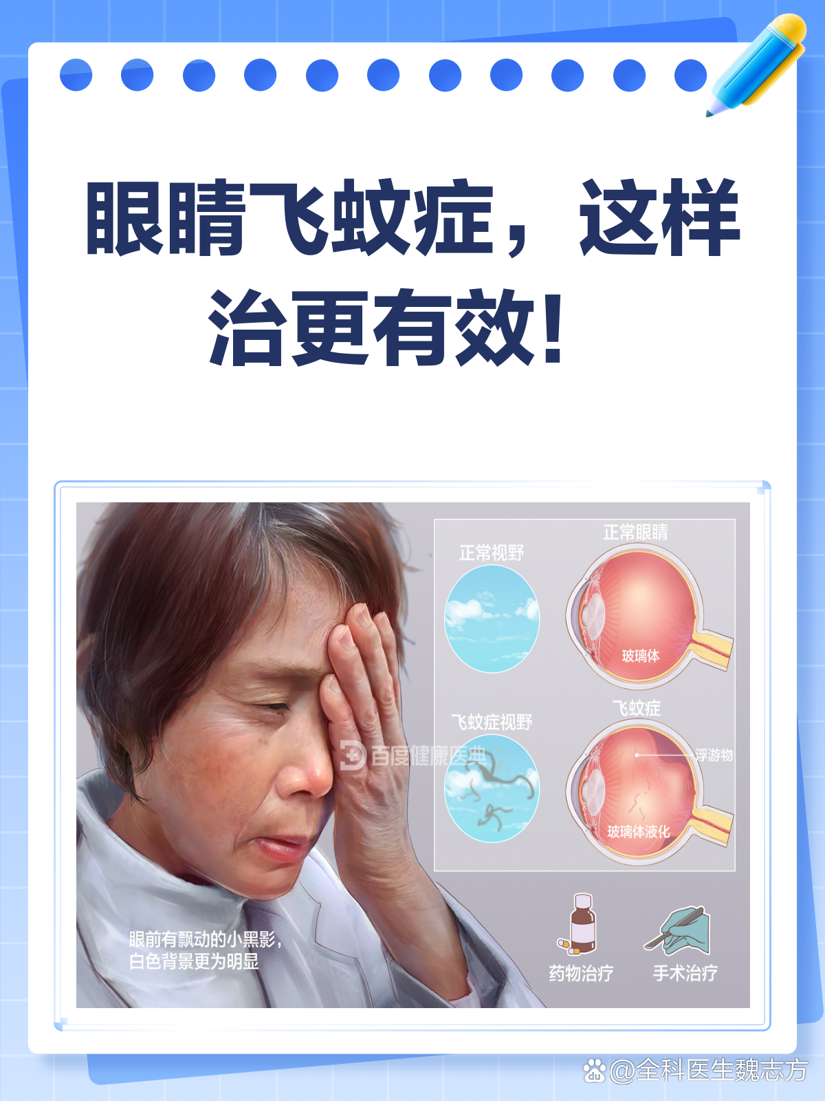 飞蚊症护眼方法 眼保健操 热敷 2026 图片展示